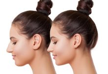 Photo of Плюсы и минусы пластической хирургии